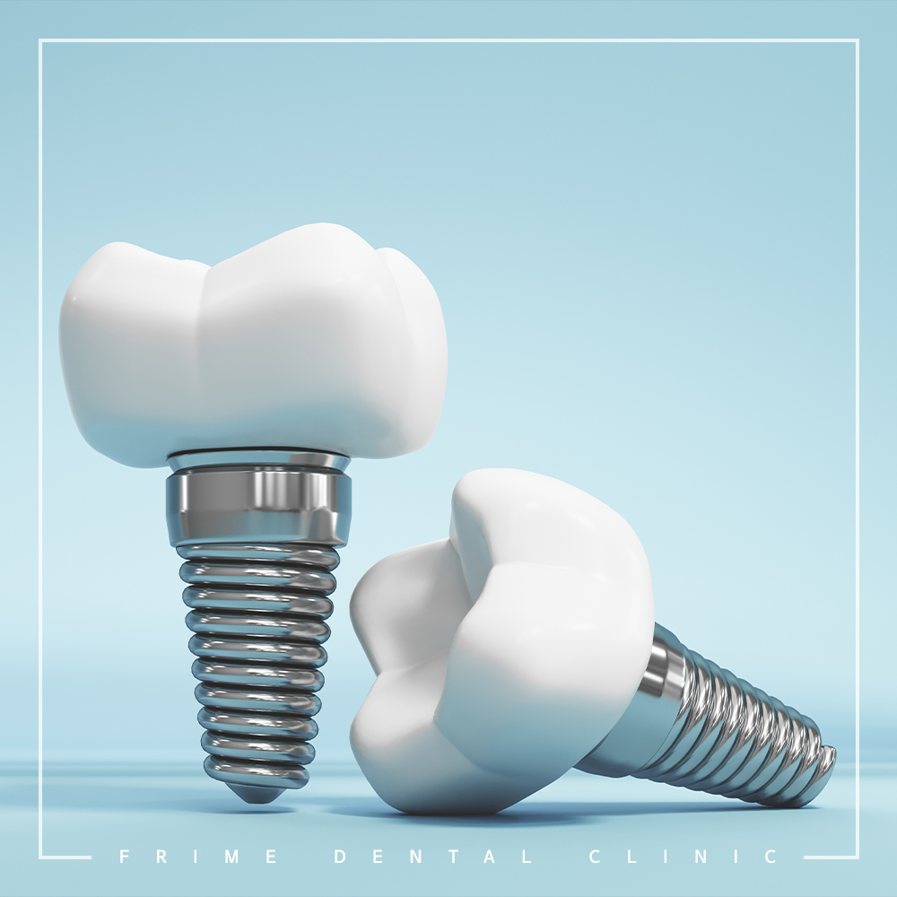 전주신시가지임플란트