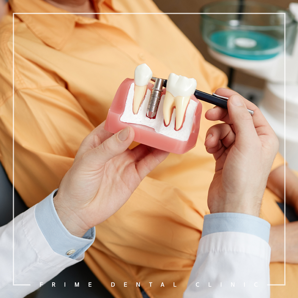 최소침습 임플란트