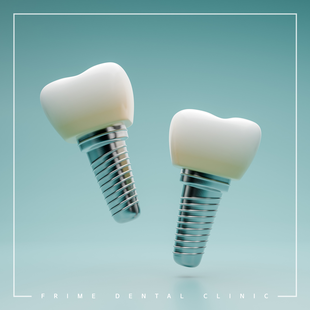 최소침습 임플란트