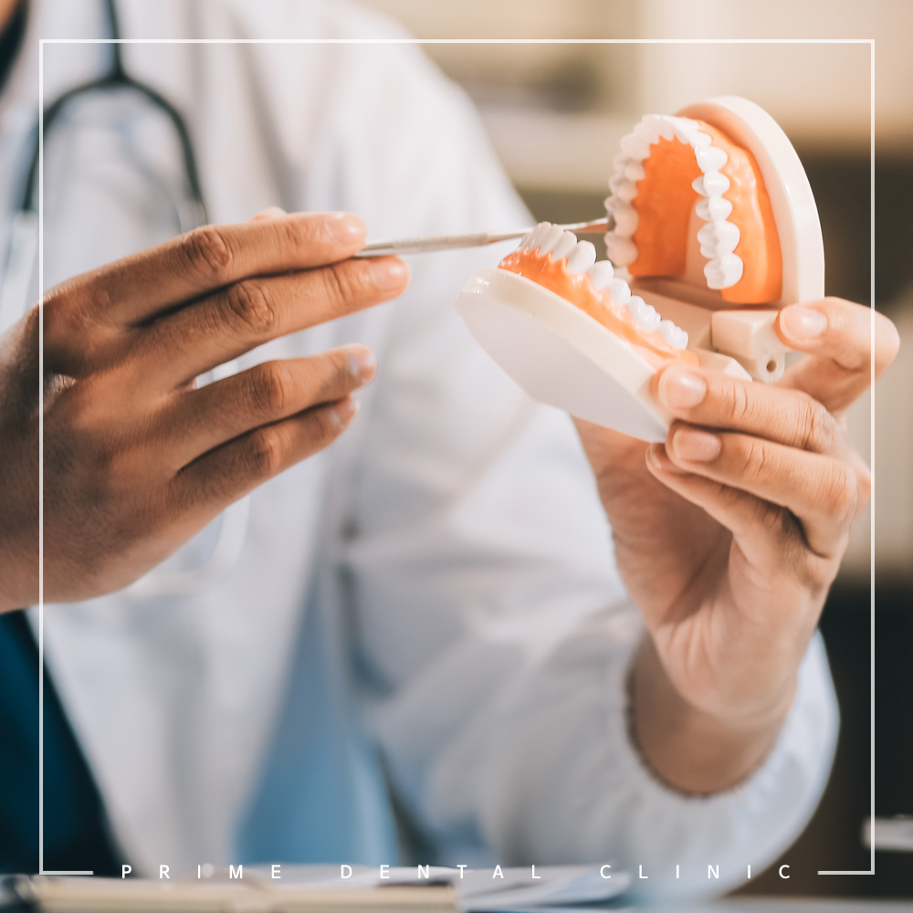 완산구임플란트