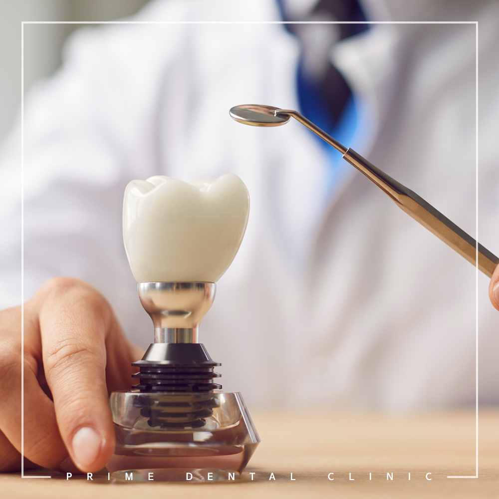 최소침습임플란트