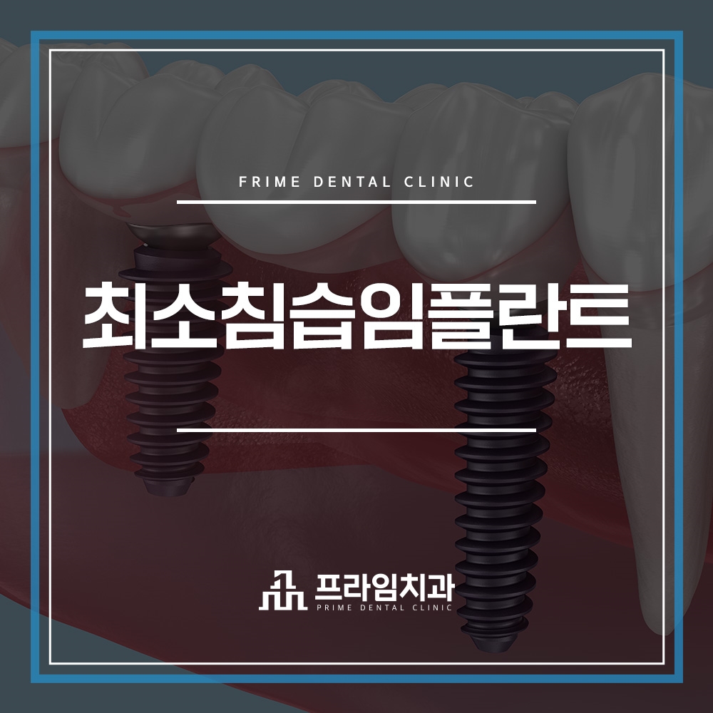 최소침습임플란트잘하는치과
